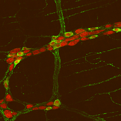 Researchers have confirmed there is a gut-brain nervous system link in autism.