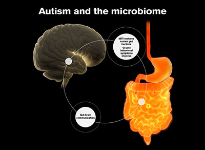 An altered bacteria profile in the gut is linked to behaviours that challenge in autism, a new study suggests
